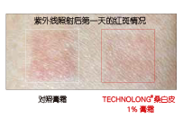 桑白(bái)皮(圖6)